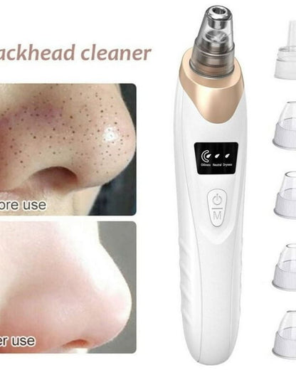 Facial Pore Cleaner