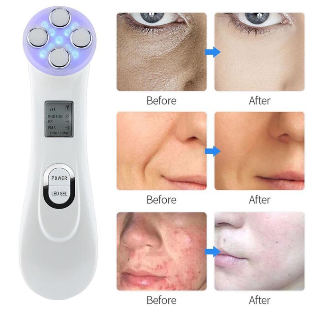 5 in 1 Multifunctional Skin Tightening Facial Massager